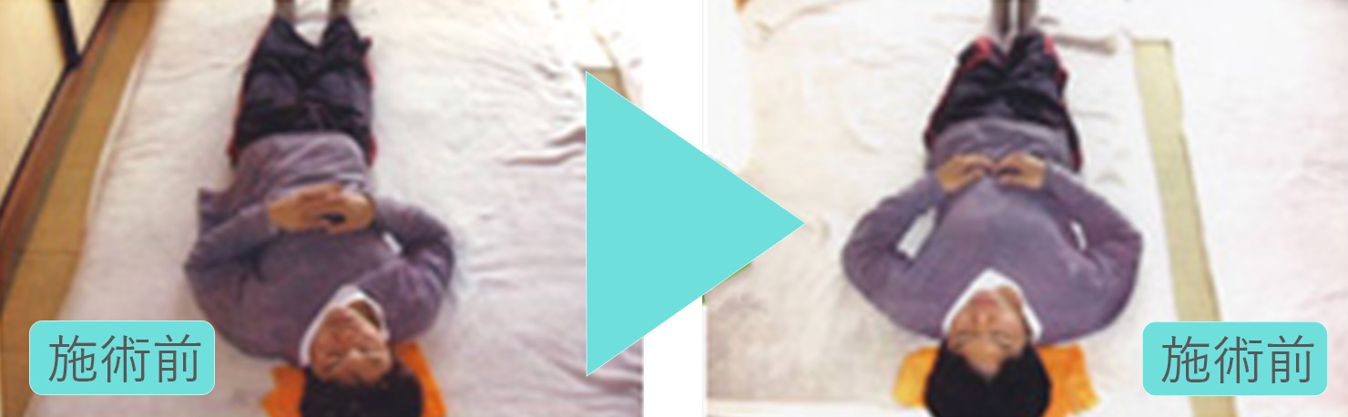 腰の激痛(立つ事も前に歩けず、話す事も呼吸も困難