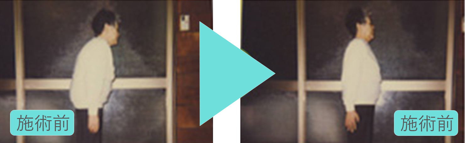 骨粗しょう症 2.脳血栓 3.肩、手足の痛み・痺れ O脚 5.白内障 6.血圧の異常